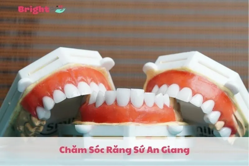 Chăm Sóc Răng Sứ An Giang 2025: Top 8 Nha Khoa Uy Tín và Dịch Vụ Tốt Nhất | Bright Doctors
